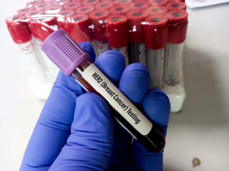 Second-line antibody-drug conjugate in a patient with HR-positive, HER2-low advanced breast cancer