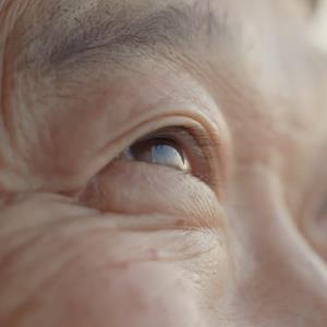 Maximizing outcomes in nAMD and PCV with a multitargeted VEGF inhibitor