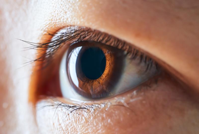 Achieving optimal outcomes in DME with a VEGF inhibitor