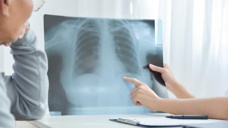 Is TBLC safe for patients with unclassifiable ILD?