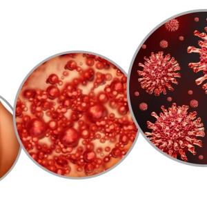 Prioritizing herpes zoster prevention in patients with chronic diseases or immune-compromised conditions