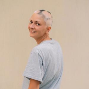 Dual JAK3/TEC inhibition may induce hair regrowth in alopecia areata