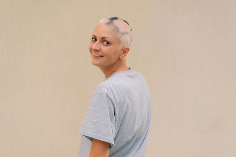 Dual JAK3/TEC inhibition may induce hair regrowth in alopecia areata