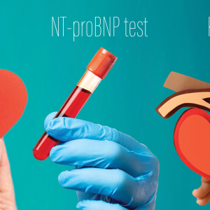 NT-proBNP predicts cardiorenal complications, improves risk stratification in Chinese T2D patients
