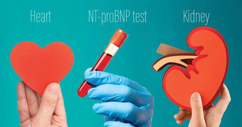 NT-proBNP predicts cardiorenal complications, improves risk stratification in Chinese T2D patients