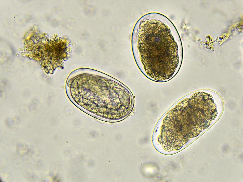 Fixed-dose albendazole–ivermectin combo shows promise in T. trichiura, hookworm infections