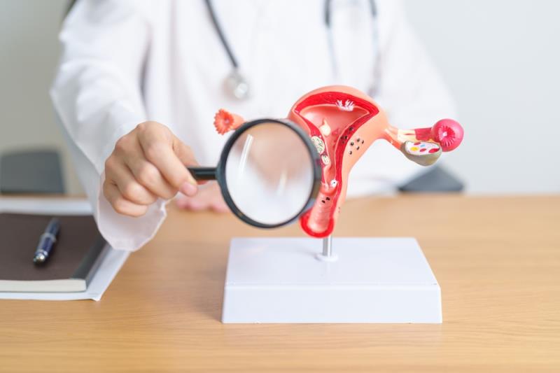 Study pinpoints factors affecting cervical cancer screening participation in Singapore