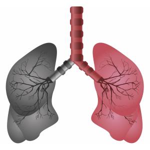 Vitamin D deficiency predicts rapid lung function decline in smokers