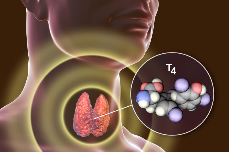 Subclinical hyperthyroidism not a risk factor for MACE in PCI patients