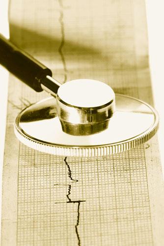 Acoramidis lowers mortality, CV hospitalization in ATTR-CM
