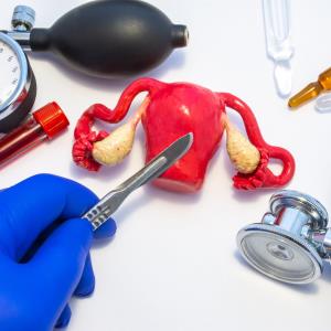 Early hysterectomy poses increased CVD risk