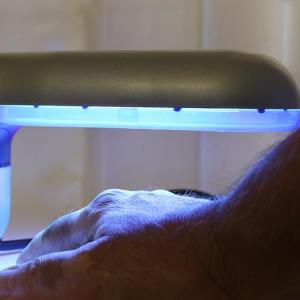 In-home phototherapy delivers promising results in psoriasis