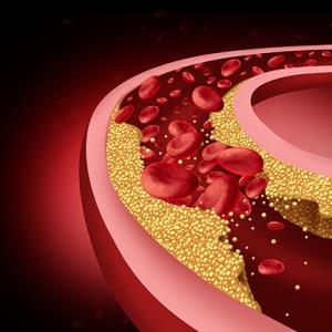 ‘Inclisiran first’ strategy in ASCVD reduces LDL-C