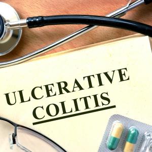 Tofacitinib effective in ulcerative colitis, but higher doses lead to adverse events