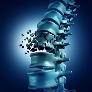 Infrequent zoledronate infusions prevent vertebral fractures in early postmenopausal women