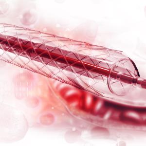 Drug-coated balloon angioplasty may be effective for infrapopliteal disease