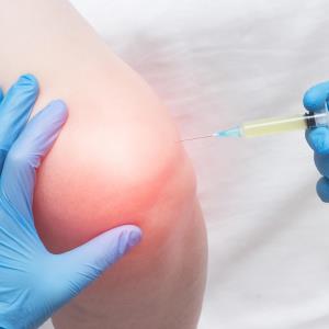 Intra-articular prolotherapy a treatment alternative for knee OA?