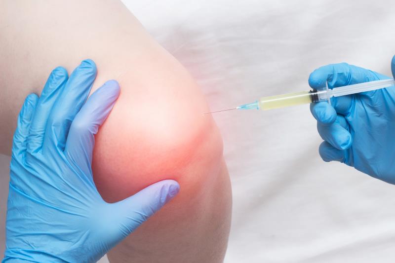 Intra-articular prolotherapy a treatment alternative for knee OA?