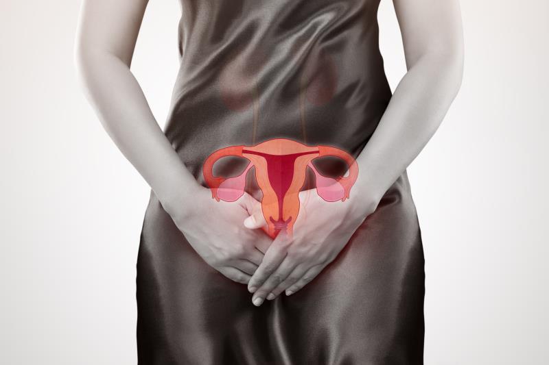 Intraperitoneal carboplatin ups PFS in ovarian cancer