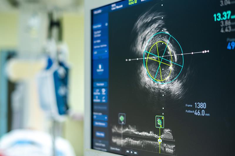 Intravascular ultrasound-guided stenting delivers improved outcomes for ACS patients