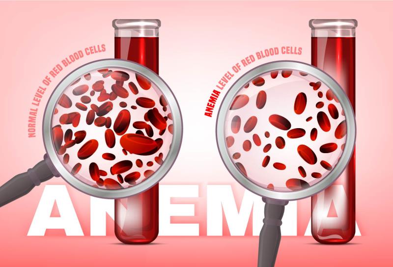 IV iron isomaltoside lowers hypophosphatemia incidence in iron deficiency anaemia