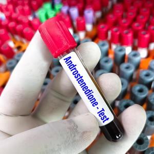 Investigational drug for paediatric congenital adrenal hyperplasia succeeds in phase III trial