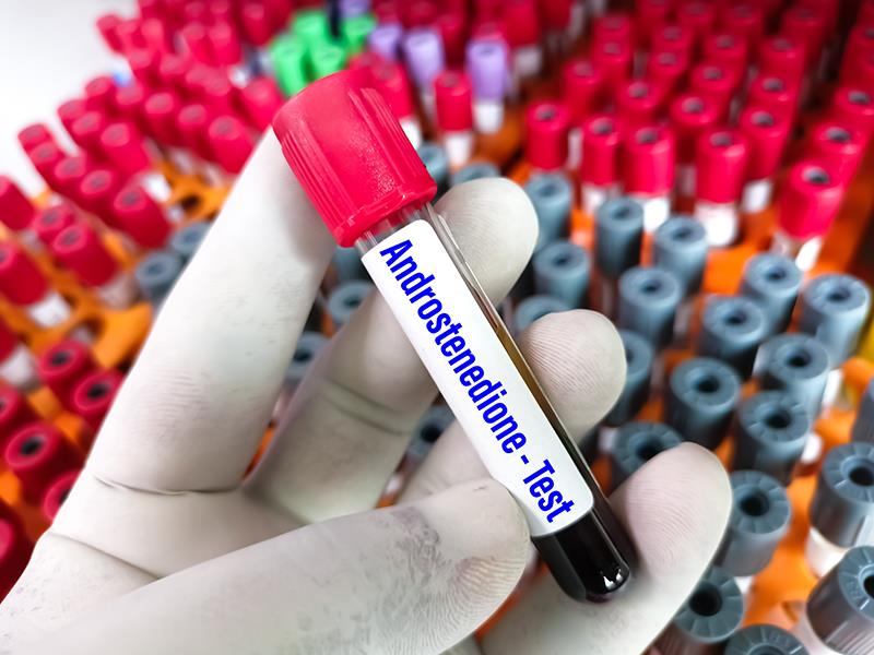 Investigational drug for paediatric congenital adrenal hyperplasia succeeds in phase III trial