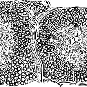 Ipragliflozin shows benefits for T2D patients with NAFLD