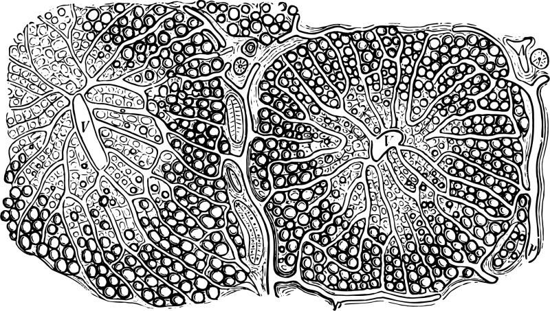 Ipragliflozin shows benefits for T2D patients with NAFLD