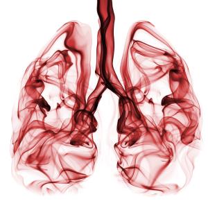 Atezolizumab bests chemo in advanced NSCLC