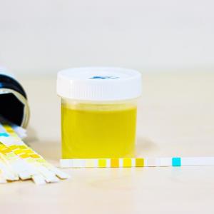 Iptacopan safe, effective in patients with C3G