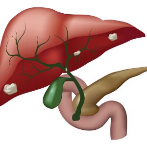 Ivosidenib a ray of hope for rare biliary tract cancer?