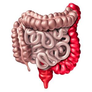 JAK inhibitors tied to high remission rates in older adults with IBD