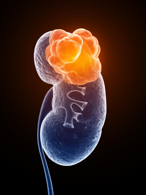 Automated performance metrics may predict outcomes during robotic partial nephrectomy