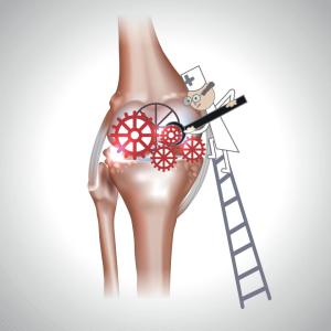 Young age, osteomyelitis, pyogenic bacterial isolation predict sequelae in septic arthritis