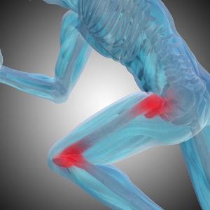 Statin use tied to joint replacement risk