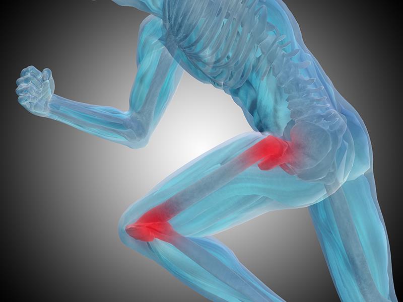 Statin use tied to joint replacement risk