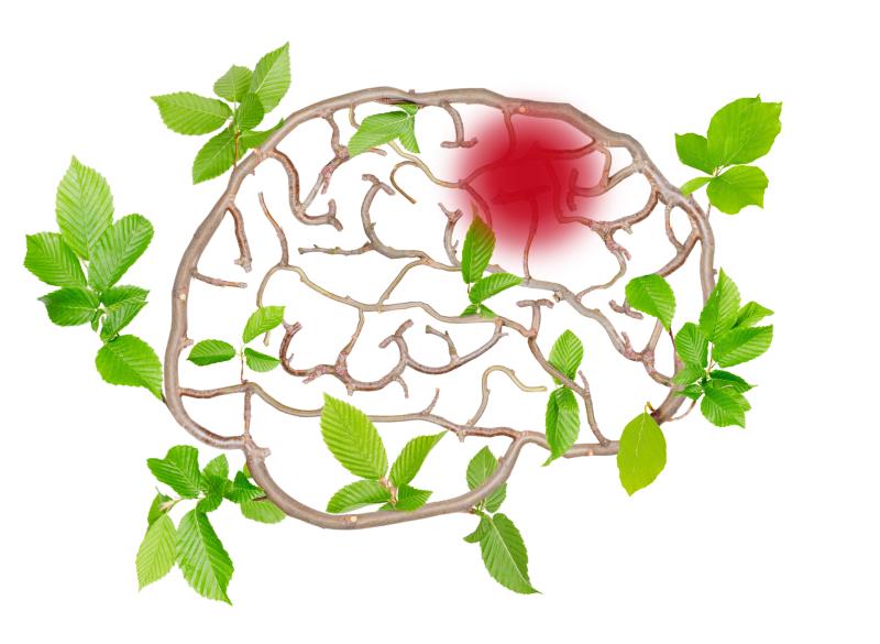 LACI-2 sets stage for cilostazol-isosorbide combo in lacunar stroke