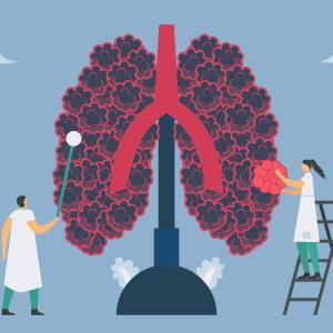 Lazertinib improves PFS vs gefitinib in 1L treatment of EGFR-mutated NSCLC