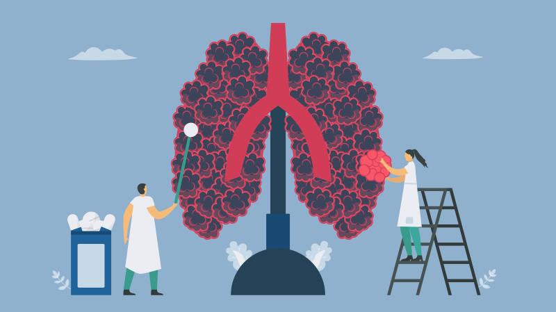 Lazertinib improves PFS vs gefitinib in 1L treatment of EGFR-mutated NSCLC