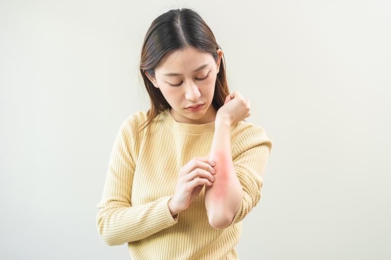 Lebrikizumab relieves itch, skin pain in AD patients previously on dupilumab