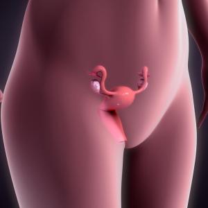 No major pregnancy complications seen after fibroid ablation