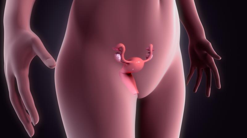 No major pregnancy complications seen after fibroid ablation