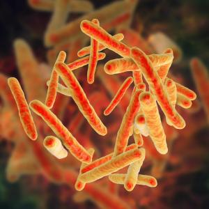 Underweight people at greater risk of tuberculosis