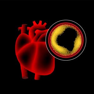 Is liraglutide cardioprotective in T2D patients?