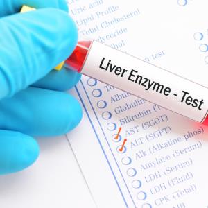 Liver enzyme elevations in COVID-19 secondary to other conditions