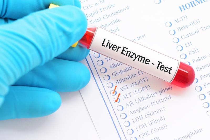 Liver enzyme elevations in COVID-19 secondary to other conditions