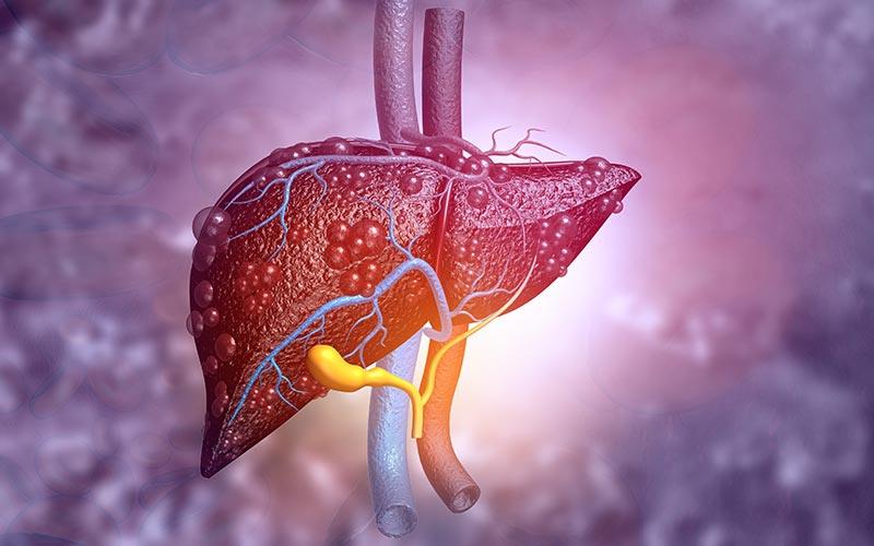 Liver injury may be hallmarks of severe COVID-19