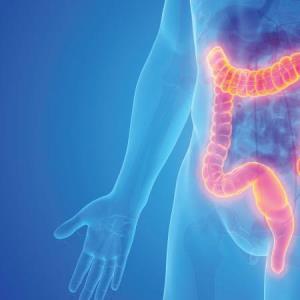 Is ChatGPT ready to give CRC screening recommendations?