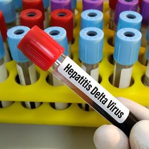Long-term bulevirtide use safe, efficacious in chronic HDV